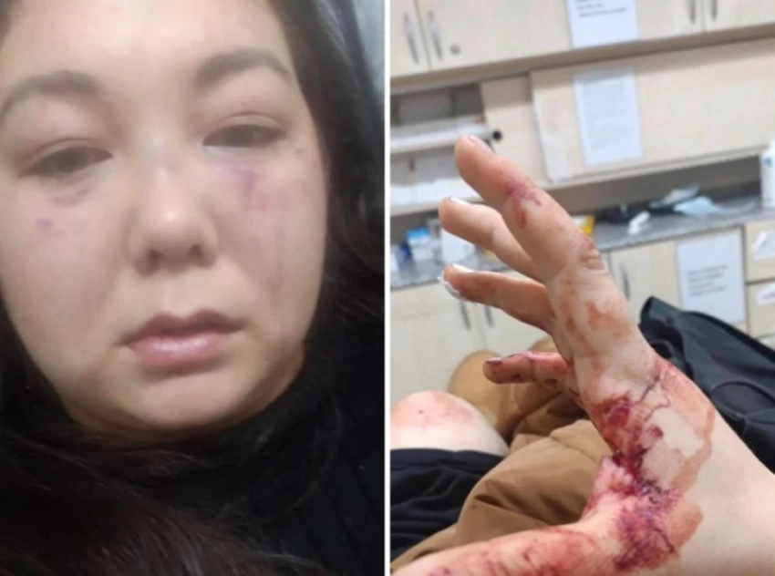 Кыргызстанке, которую в Анталье избивал муж-турок, помогли вернуться на родину