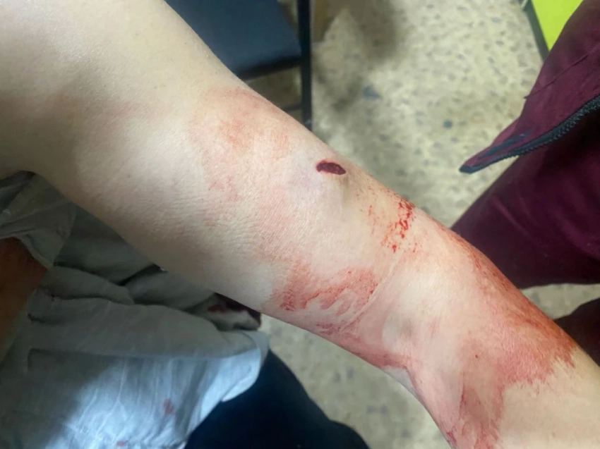 В Бишкеке мужчина жестоко избил жену и нанес ей ножевое ранение. Подозреваемый задержан