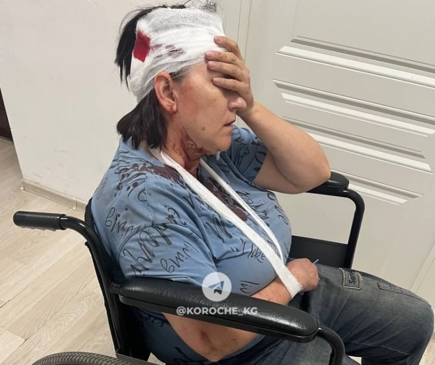 В центре Бишкека самокатчик сбил женщину и скрылся, она попала в реанимацию
