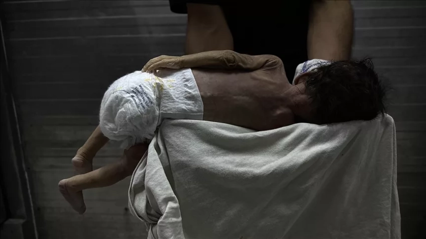 В секторе Газа двухмесячный ребенок умер от недоедания. Из-за массового голода в секторе погибли 274 человека, в том числе 113 детей