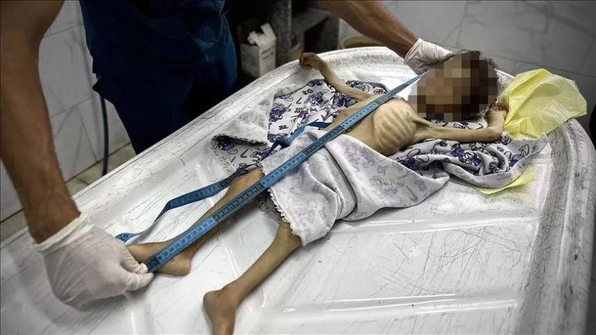 Британский патолог: нищета в Газе наглядно показывает, на что один народ способен по отношению к другому