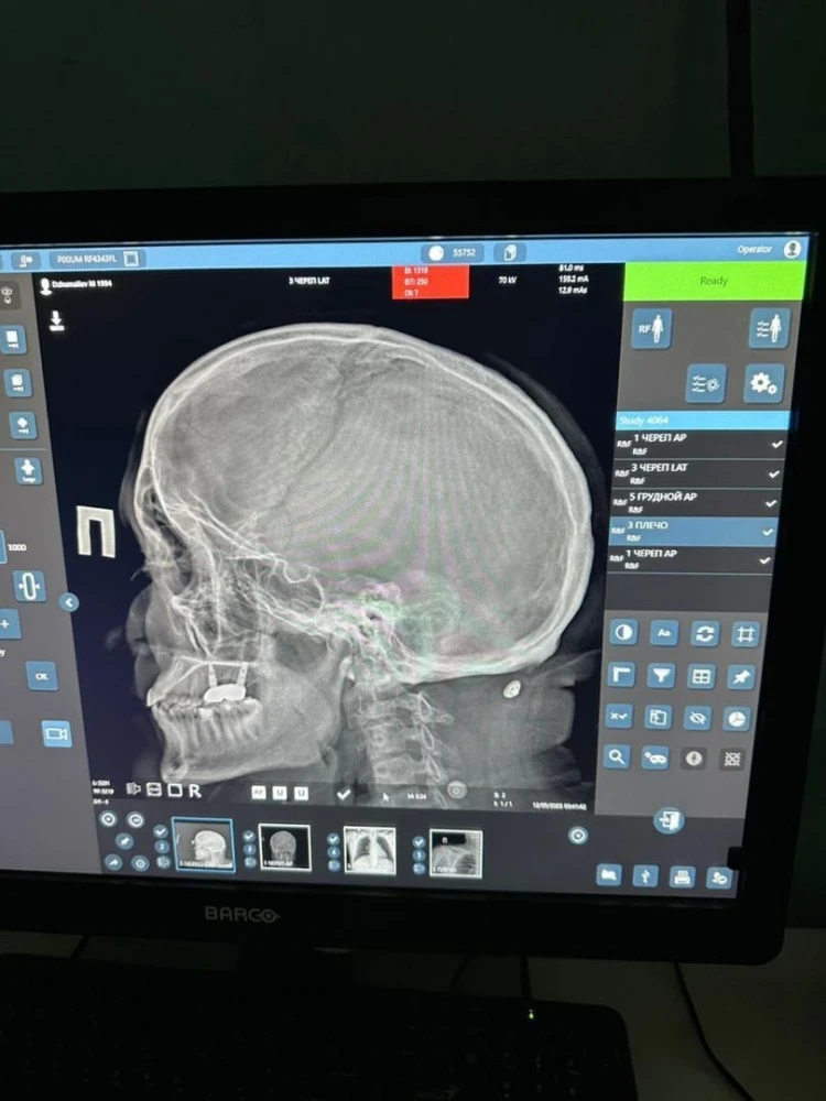 В Бишкеке жестоко избили врача. Он перенес несколько операций, а милиция тянет дело