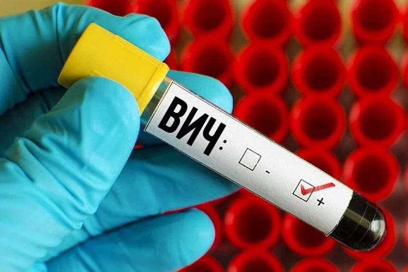 В Узбекистане от экс-посла потребовали сдать тест на ВИЧ при въезде в страну