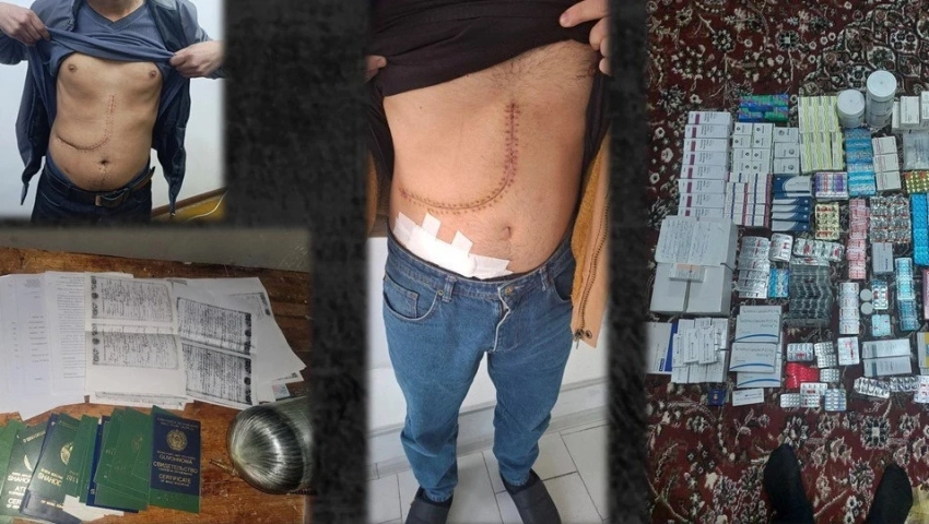 В Узбекистане заявили о поимке торговцев человеческими органами