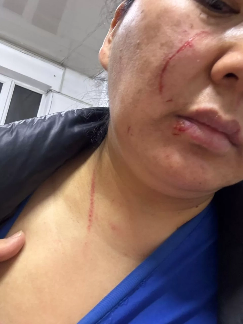 Конфликт в Кара-Жыгаче: Женщина из видео рассказала свою версию, показала ушибы и раны