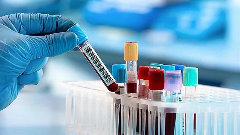 Мигрантов в России будут проверять на наличие гепатита В и С