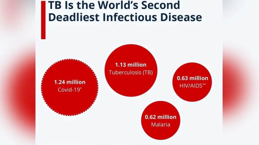 Монголия планирует снизить смертность от туберкулеза на пять процентов
