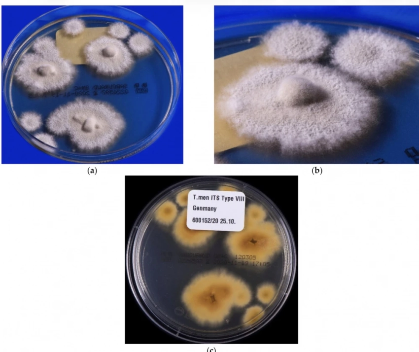 В Европе стремительно распространяется супергрибок, поражающий пах и ягодицы