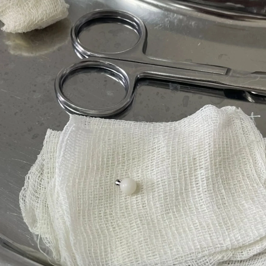 Врачи успешно удалили инородное тело из бронха ребенка в Бишкеке