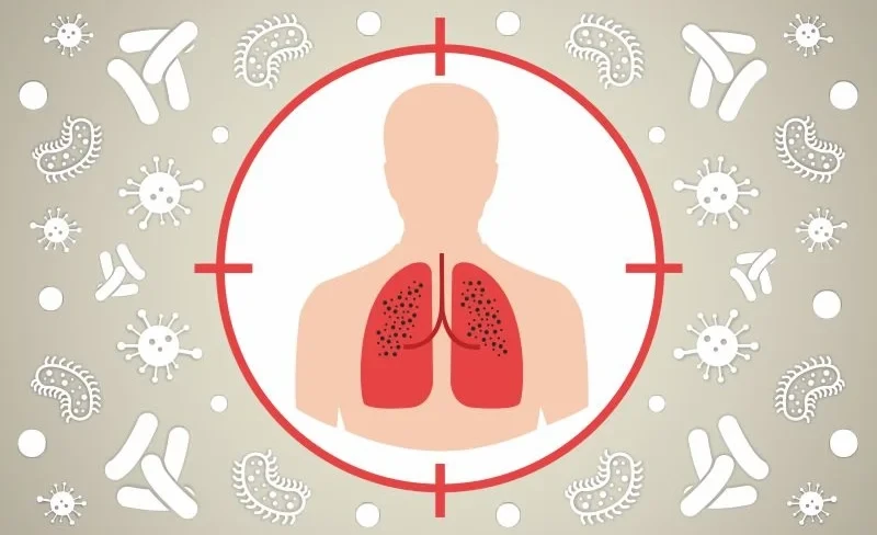 Туберкулез. Что нужно знать о болезни и почему важно вовремя обращаться к врачу